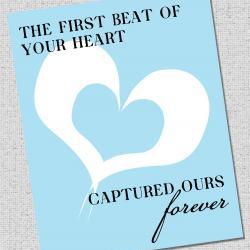 Nursery Art Print "The first beat of your heart captured ours"